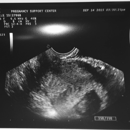 First Ultrasound.jpg