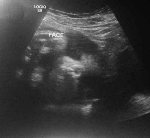 Screen Shot 2016-06-21 at 4.16.50 PM.png