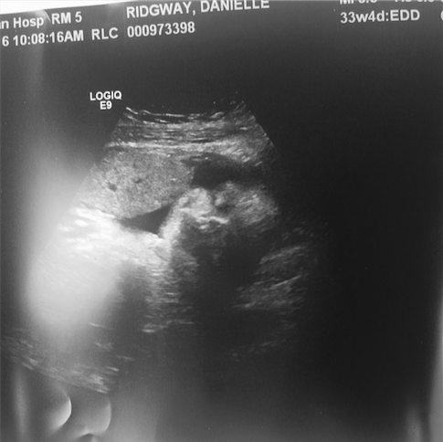 Screen Shot 2016-06-28 at 3.50.46 PM.png