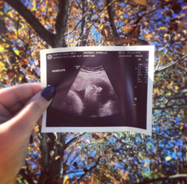 Screen Shot 2016-11-05 at 1.45.28 PM.png